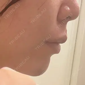 AI Beauty Clinic （エーアイ美容クリニック）口コミ