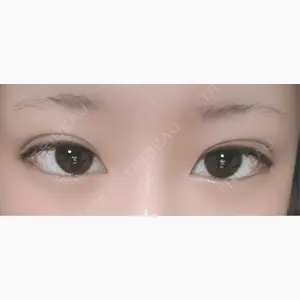 アリエル美容クリニック 郡山院口コミ