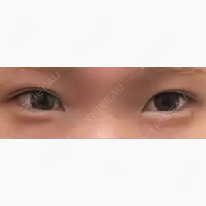 フィラークリニック 大阪梅田院口コミ