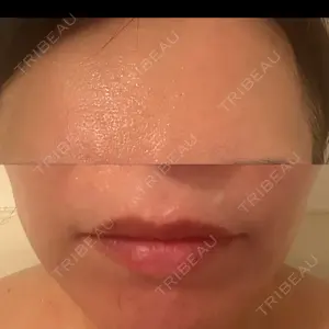 NARU Beauty Clinic 【ナルクリ】 水戸院口コミ