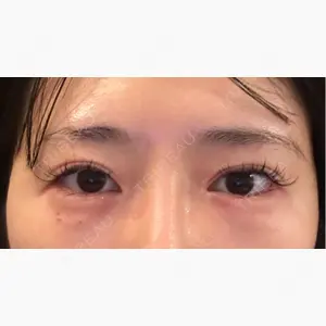 ネビュラクリニック 東京錦糸町院口コミ