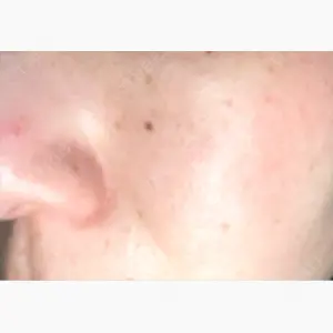 共立美容外科 仙台院口コミ