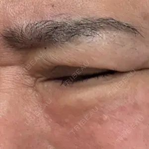 東京ココセランクリニック口コミ