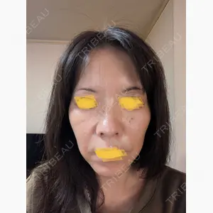 Zetith Beauty Clinic 池袋院口コミ