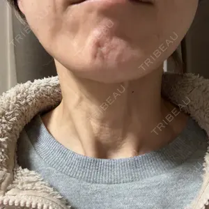 ルラ美容クリニック 町田院口コミ