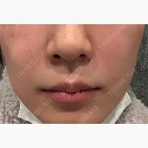 ルラ美容クリニック 福岡天神院口コミ