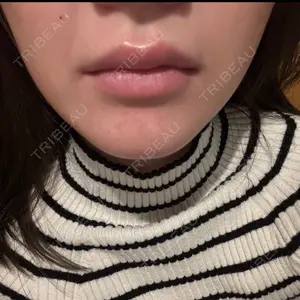 博多美容外科/美容皮膚科 ビラビューティークリニック口コミ