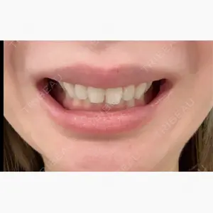 BON BON CLINIC 渋谷院口コミ