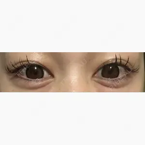 フィラークリニック 新宿院口コミ