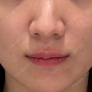 湘南美容クリニック Regno 銀座院口コミ