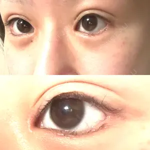 エターナル美容クリニック口コミ