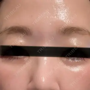 TCB東京中央美容外科 徳島院口コミ