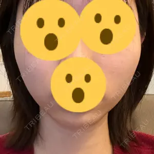 東京美容外科 福山院口コミ