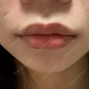 ルラ美容クリニック 郡山院口コミ