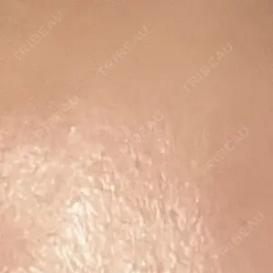 美容皮膚科エルムクリニック 麻布院口コミ