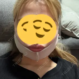 渋谷あおぞらクリニック美容外科・美容皮膚科口コミ