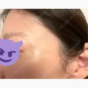 TCB東京中央美容外科 山梨甲府駅前院口コミ