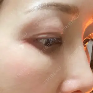 椿クリニック 名古屋院口コミ