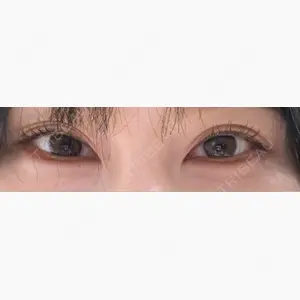 TCB東京中央美容外科 名古屋栄院口コミ