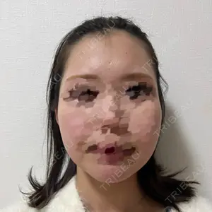 セギム美容整形外科口コミ