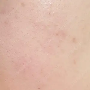 さっぽろ美容クリニック口コミ