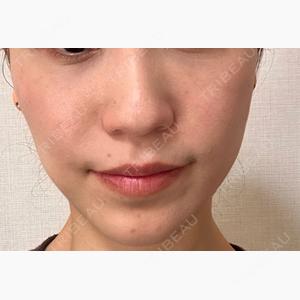 La Clinique Nagoya Sakae【ラクリニック名古屋】口コミ