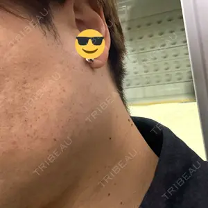 BiBiクリニック口コミ