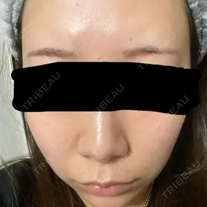 さっぽろ美容クリニック口コミ