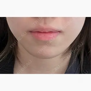 veary clinic口コミ