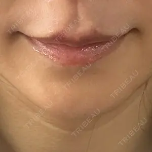 フィラークリニック 大阪梅田院口コミ