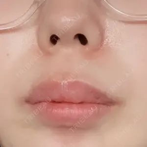 plume clinic口コミ