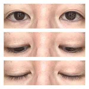 オジスキンクリニック口コミ