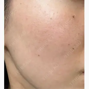 ルラ美容クリニック 郡山院口コミ