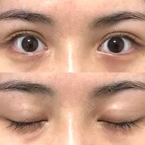 湘南美容クリニック 池袋東口院口コミ