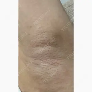 ルラ美容クリニック 渋谷本院口コミ