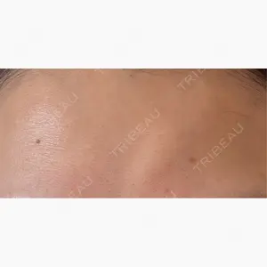 DMTC美容皮膚科 大宮院口コミ