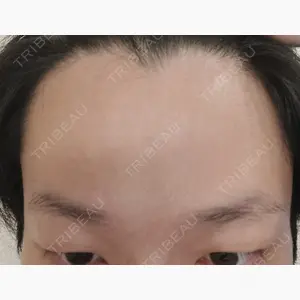 千葉美容外科アイビークリニック口コミ