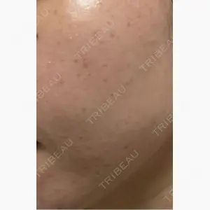 ルラ美容クリニック 町田院口コミ