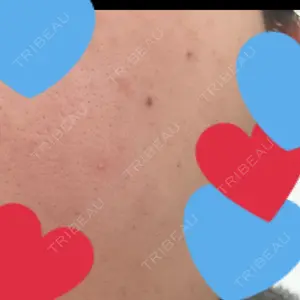 ルラ美容クリニック 神戸院口コミ