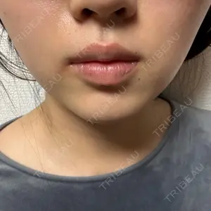 TCB東京中央美容外科 中野院口コミ