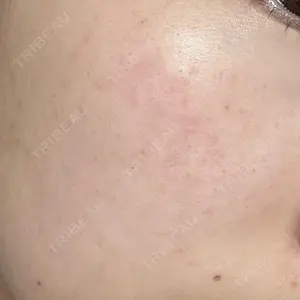 ルラ美容クリニック 神戸院口コミ