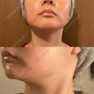 BISIN GINZA CLINIC口コミ