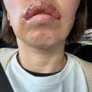 eクリニック 福岡院口コミ