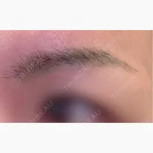 東京イセアクリニック口コミ