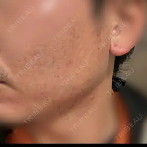 湘南美容クリニック 名古屋院口コミ