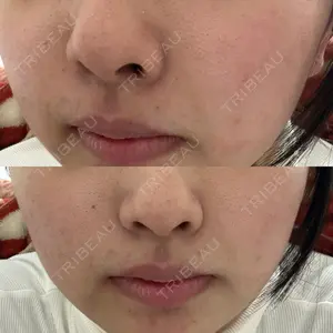 ルラ美容クリニック 四国・高松院口コミ