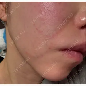 APスキンクリニック銀座口コミ