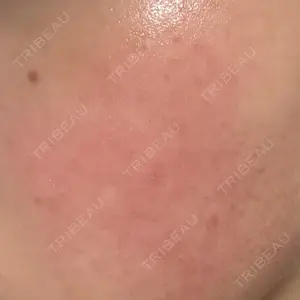 ルラ美容クリニック 仙台院 / ルラスキンクリニック 仙台院口コミ