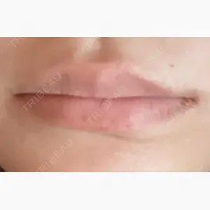 Ledian Clinic六本木口コミ