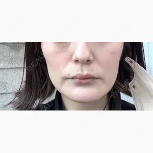 おおたかの森ビューティークリニック口コミ